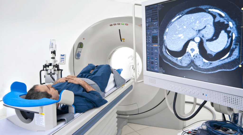 CT検査とCT画像放射線検査
